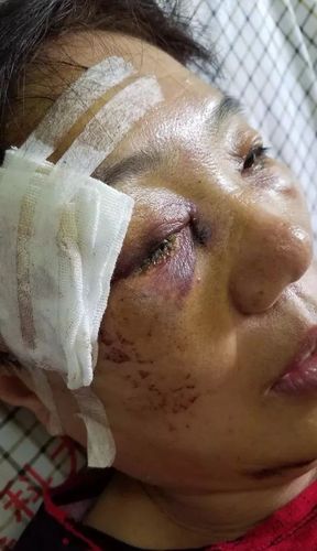 大妈转身撞人获赔7万,大妈转身撞人获赔7万元